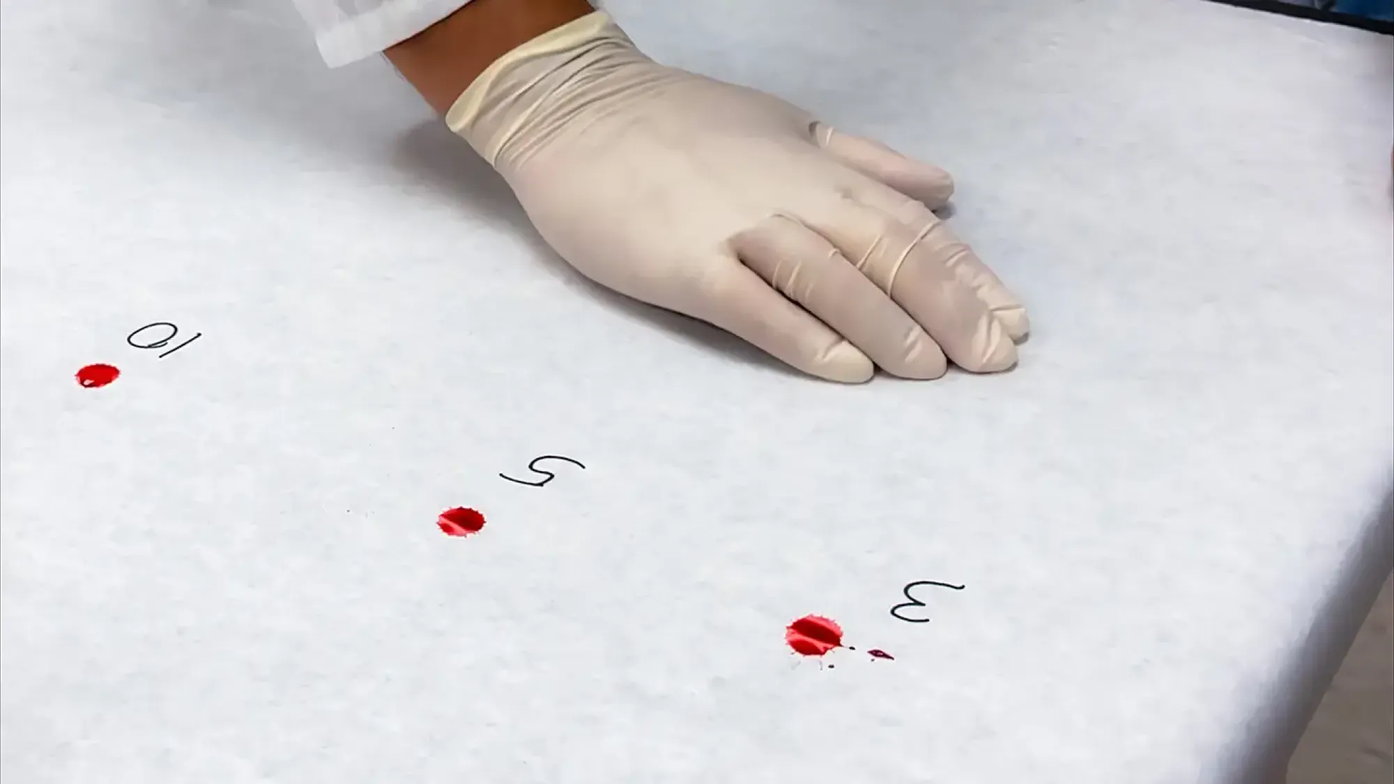Gloved hand beside three numbered blood droplets on white examination sheet.