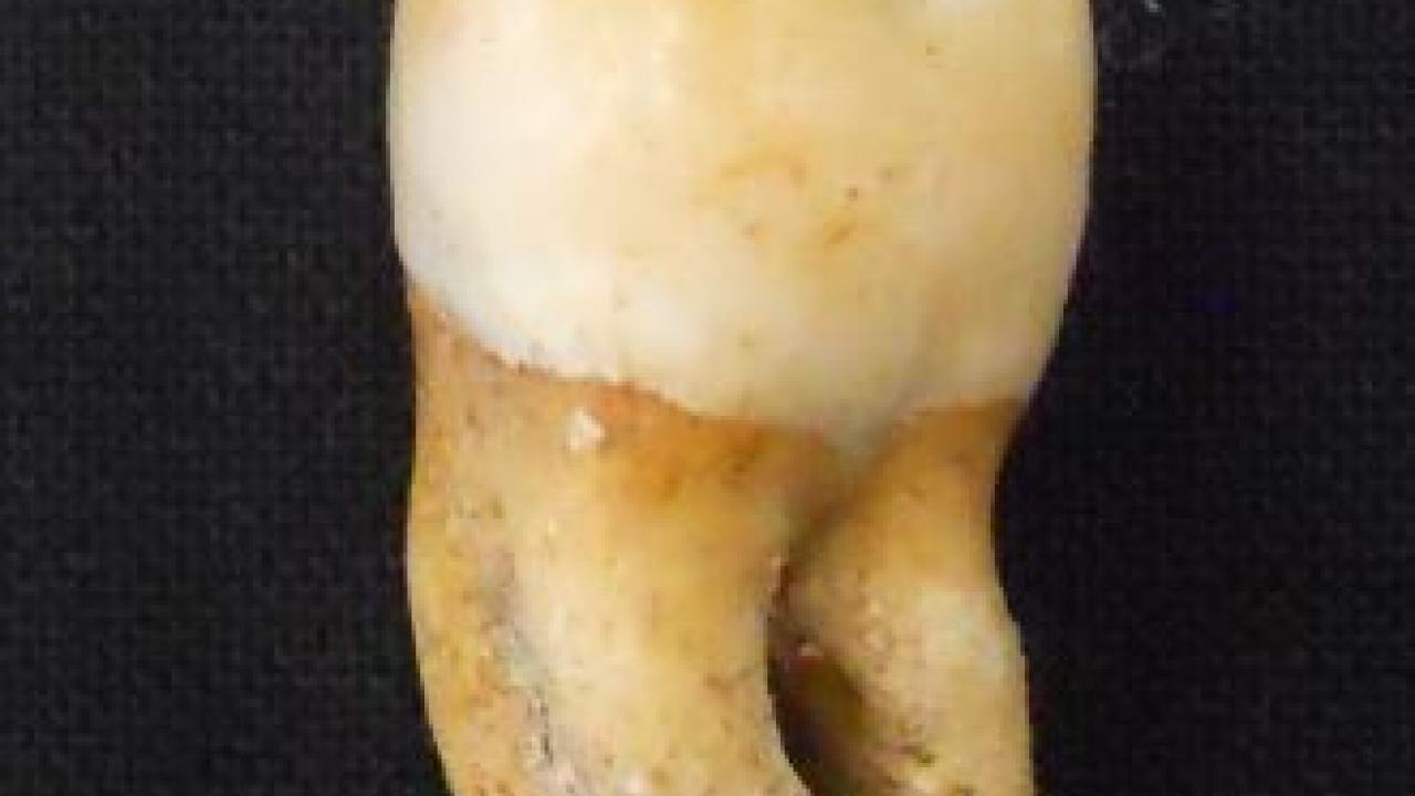 tooth