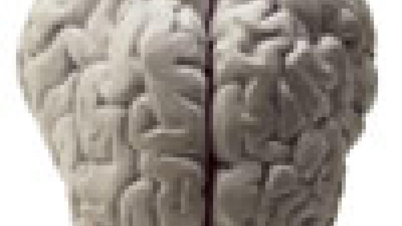 Photo: brain