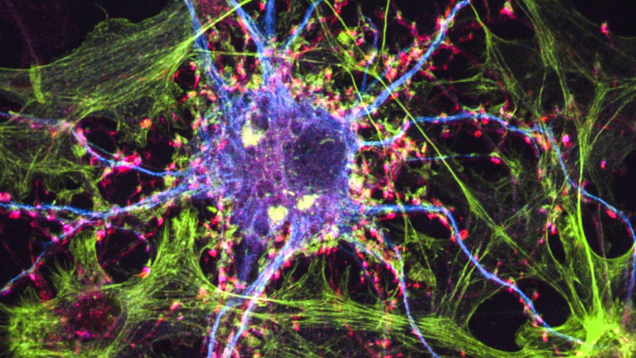 Colored image of nerve cells. 