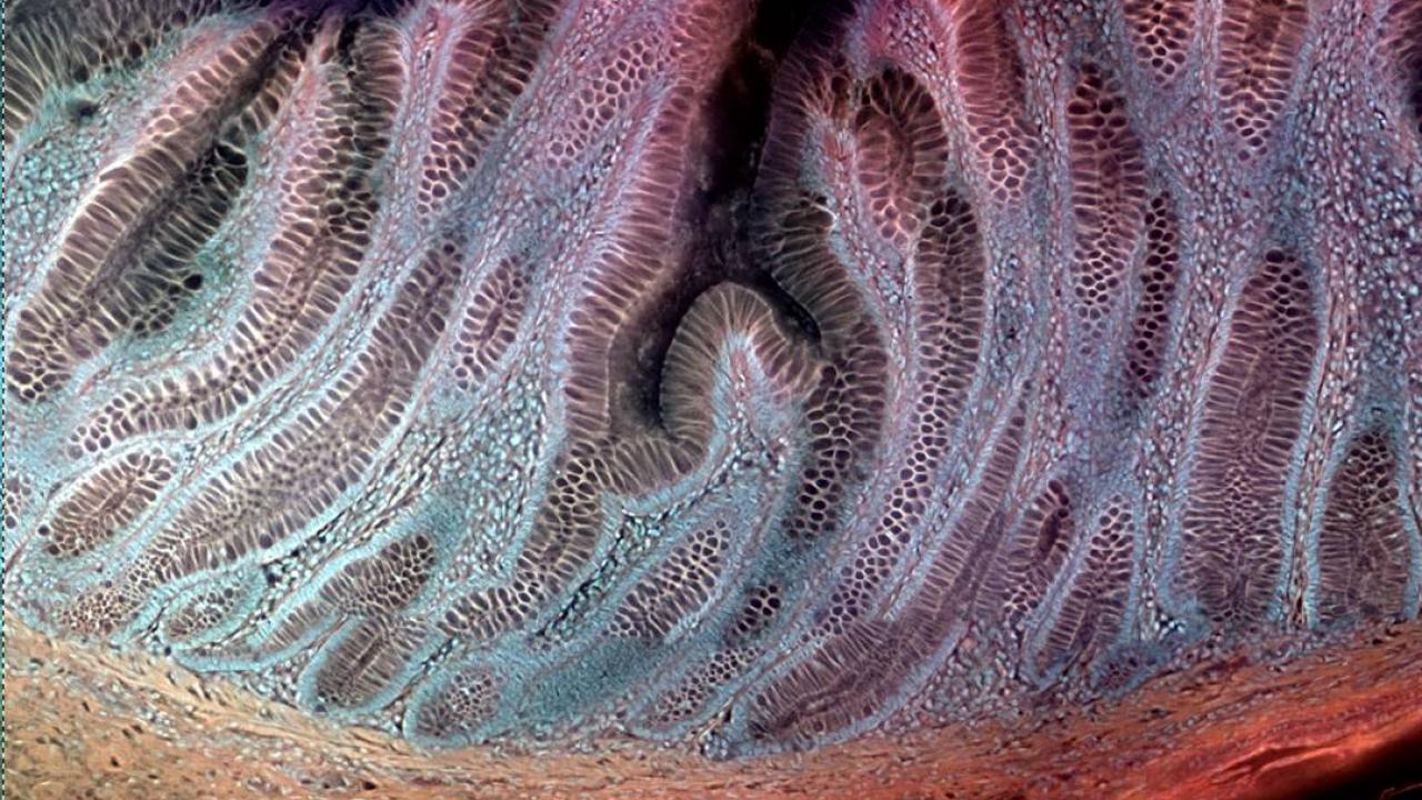 Colon under the microscope