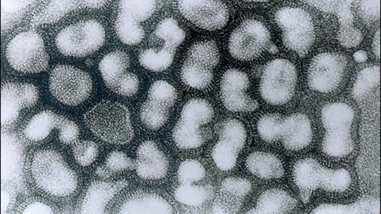 Electron micrograph photo of flu virus 