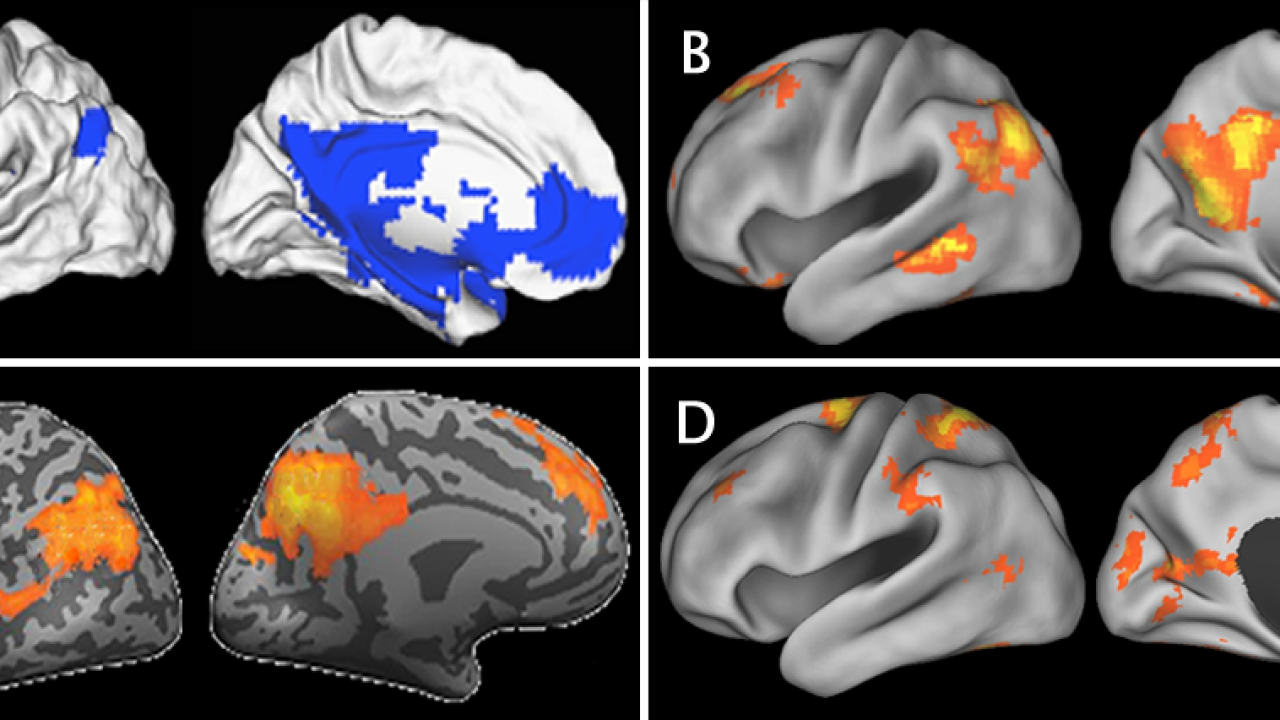 Brain images