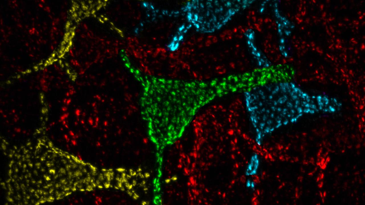 Colored image of nerve cells. 