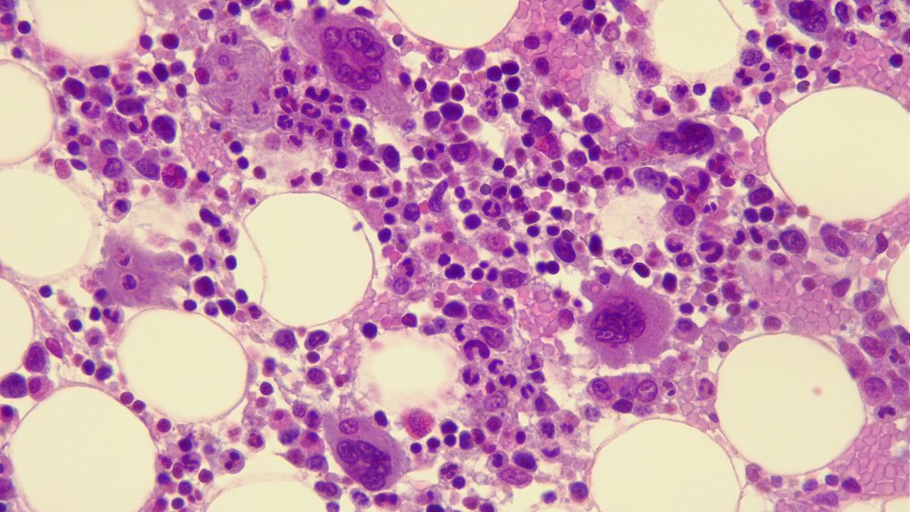 A network of purple and red dots against a pinkish background, interspersed with clear circular areas. 