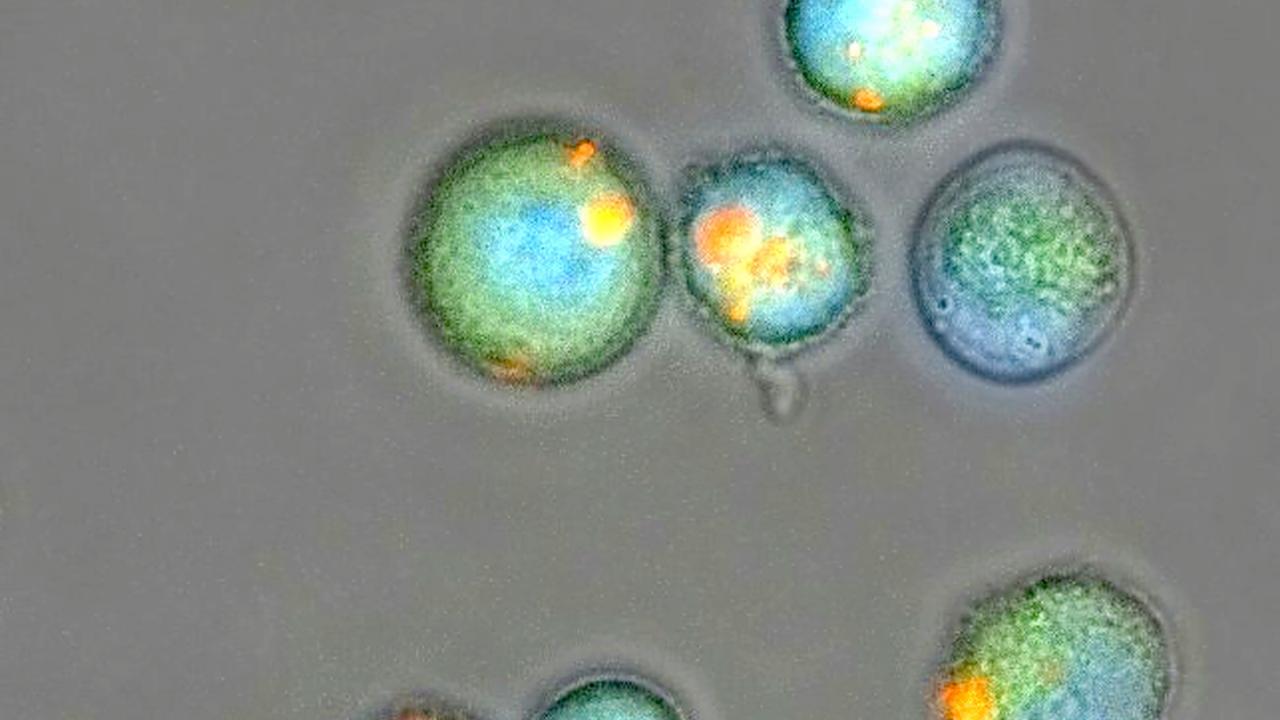 Microscope micrograph of round green cells with bright orange fluorescent spots