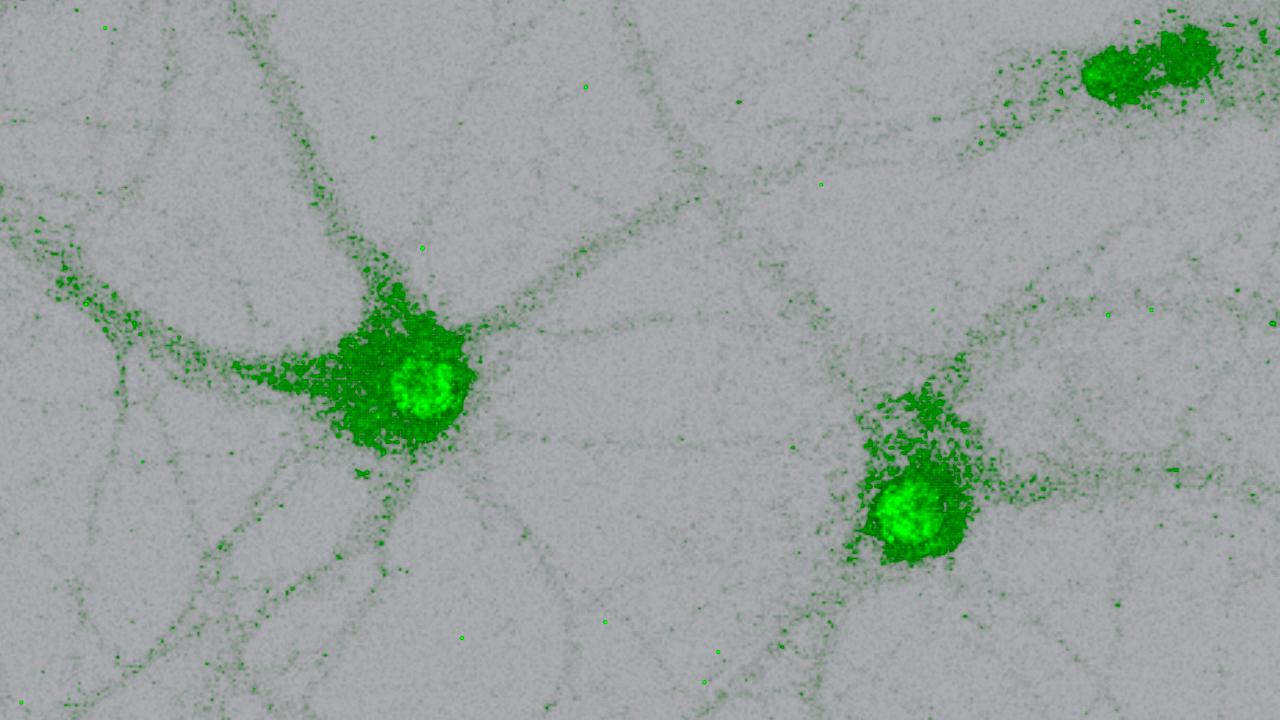 Green spindly blobs against a grey background. 
