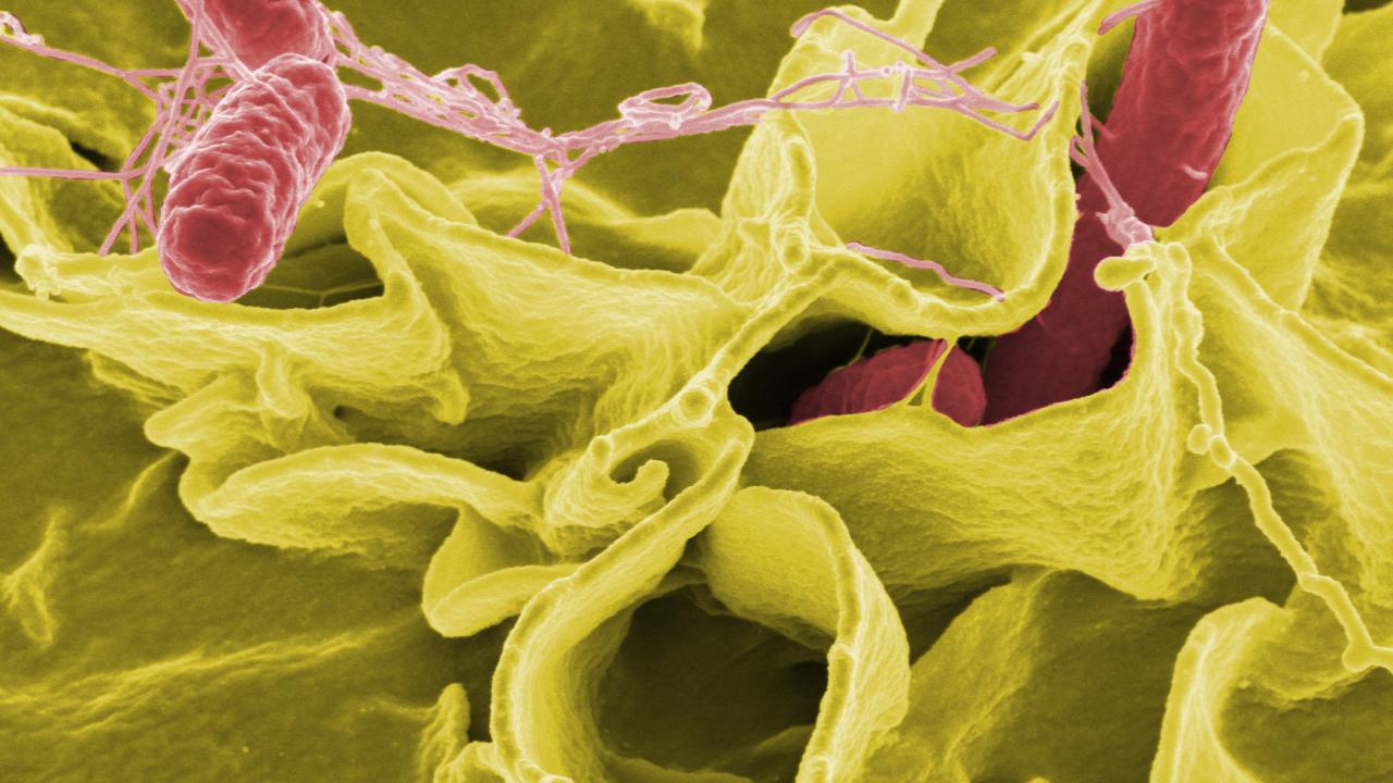 Pink, sausage shaped bacteria against a wavy yellow background. 