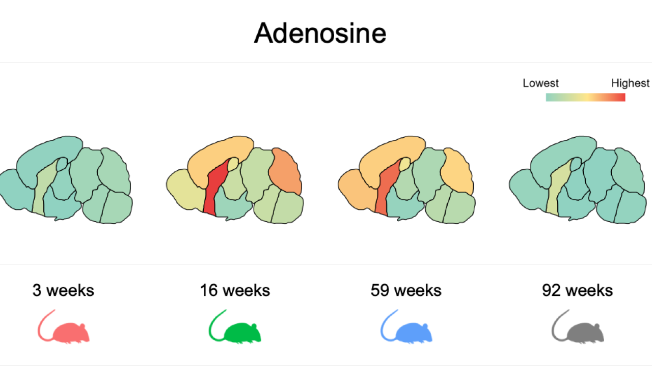 Four diagrams of mouse brains 