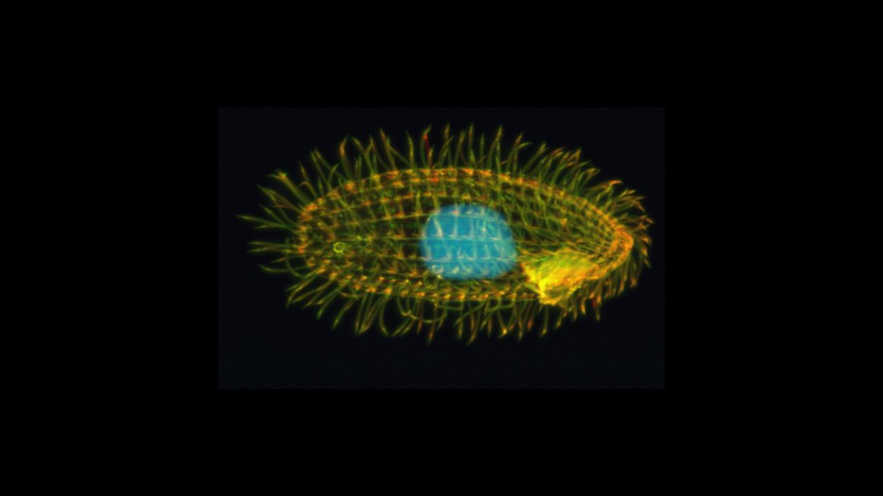 Oval-shaped organism with green/red hairs and a large blue blob in the middle 