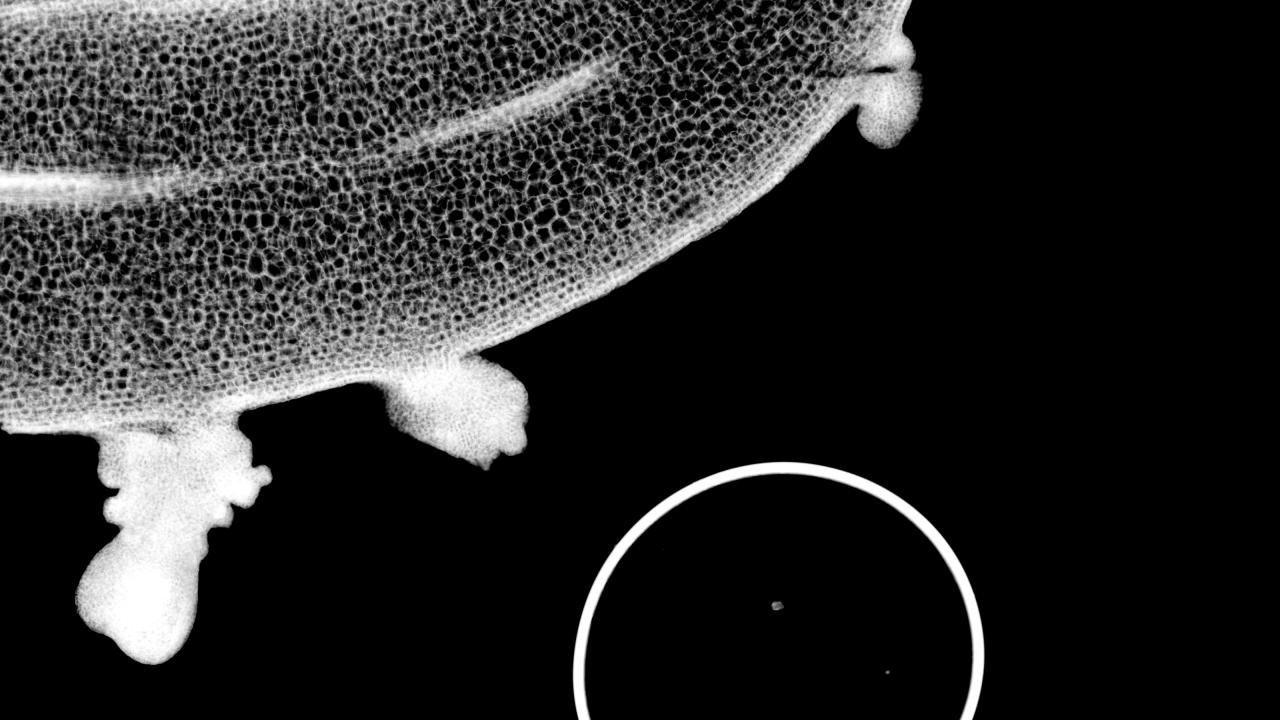 Microscope black and white image of irregular buds on a larger stem. White circle at lower right. 