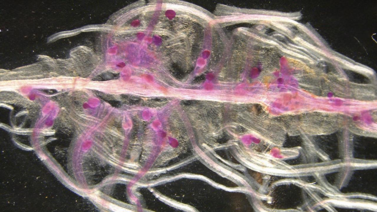 Against a black background, a tangle of translucent white fibers interspersed with purple fibers. 