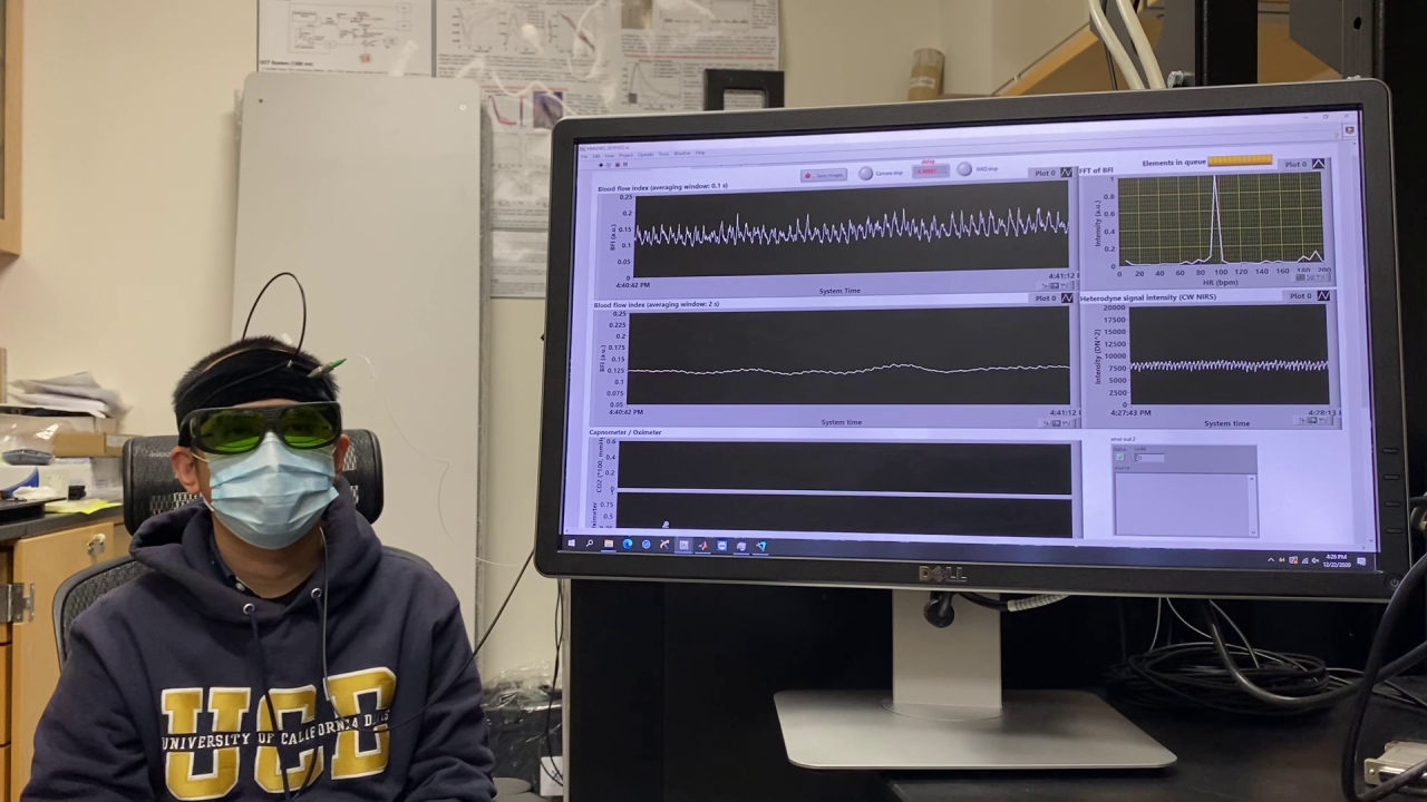 Monitoring brain blood flow in a volunteer with a new device. 