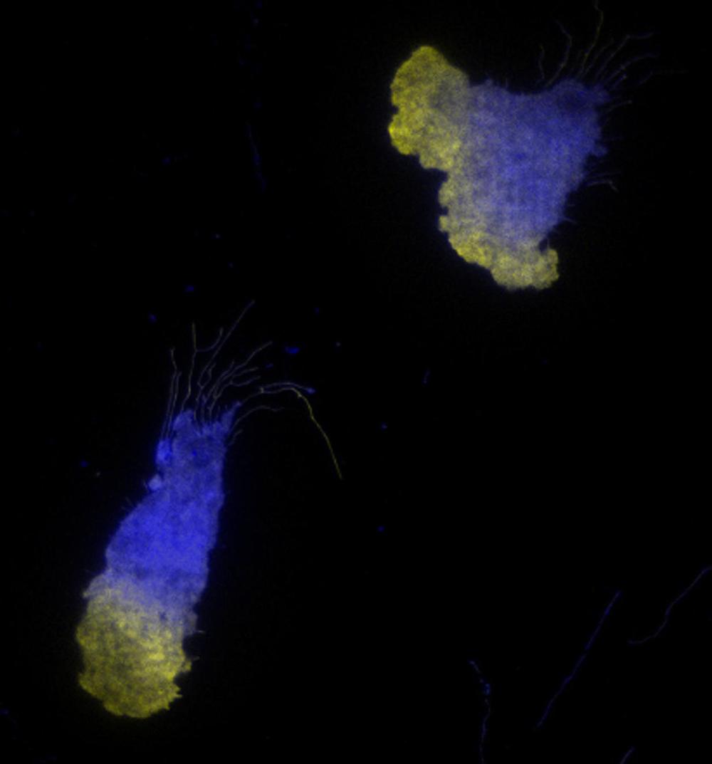 Two blobs, at lower left and upper right, with blue and green shading. Image background is black.