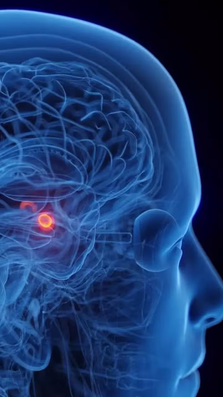 Medical illustration: translucent blue head with brain wiring and a red glowing spot near ear