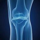 X-ray of knee