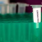 A vile of coronavirus lab results