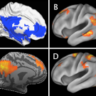 Brain images