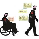 Graphic of treatment of spinal injury