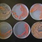 Photo: Yeast, in six Petri dishes