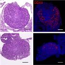 2 by 2 grid of four images: At left, two micrographs of dark pink tissue on white background. At left, dark blue images with red spots on black background. 