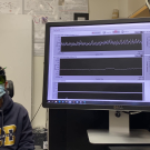 Monitoring brain blood flow in a volunteer with a new device. 